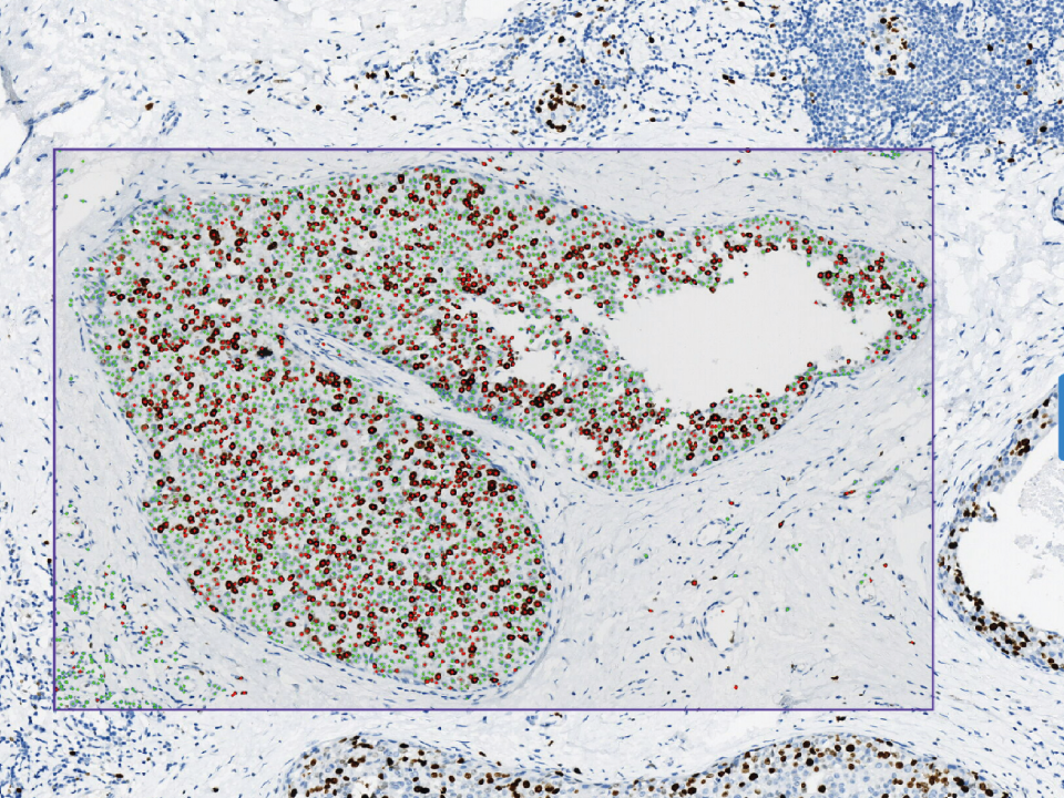 Cervical Cytology Assistant Diagnostic Module​
